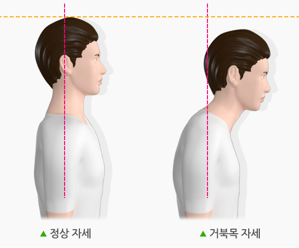 어깨 목 통증 완화